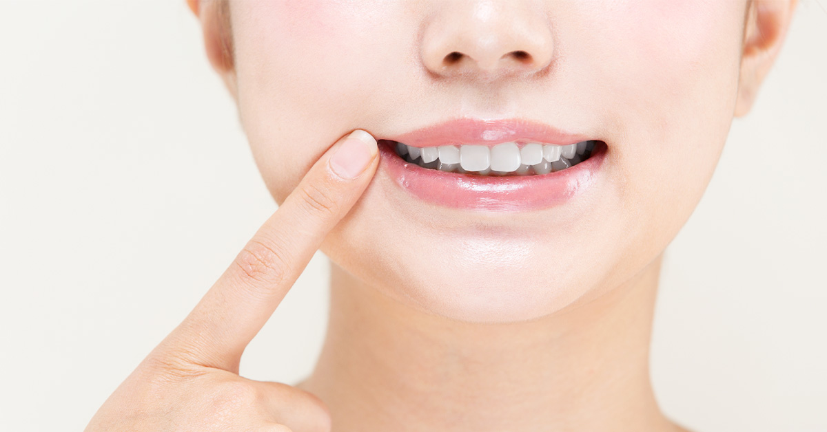 【歯の黄ばみレベルチェック】黄ばんだ歯を白くする方法やおすすめアイテムで憧れの真っ白な歯に