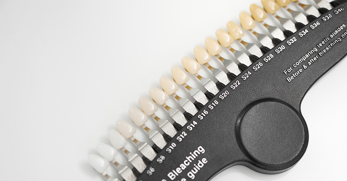 生まれつきの歯の黄ばみも白くなる?原因や白い歯を手に入れる方法で笑顔に自信を持てる白い歯に