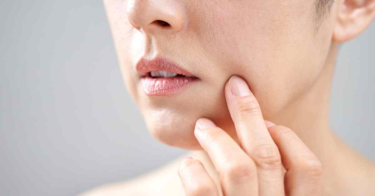 ほうれい線原因