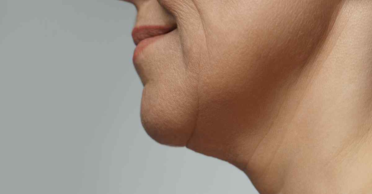 エイジングケア