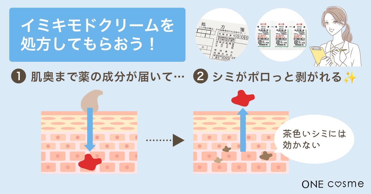 顔のシミを消す！ためしてガッテンで放送された方法は効果がある？ ポイントをしぼって番組内容と方法を解説 | ONEcosme