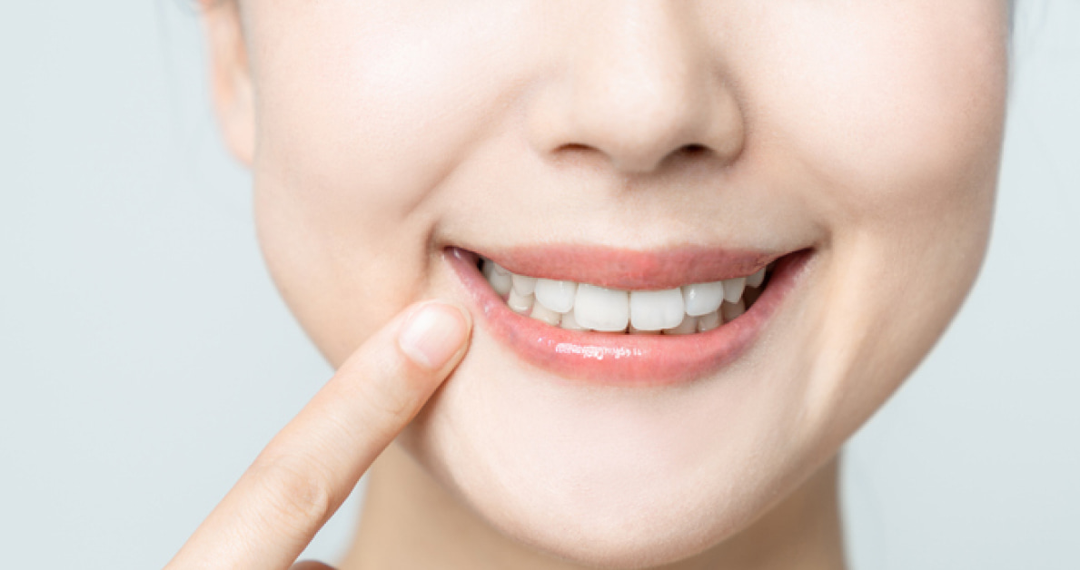 ホワイトニングは自宅でもできるって知ってる？歯医者との違いや歯を白くする方法・効果を徹底解説！