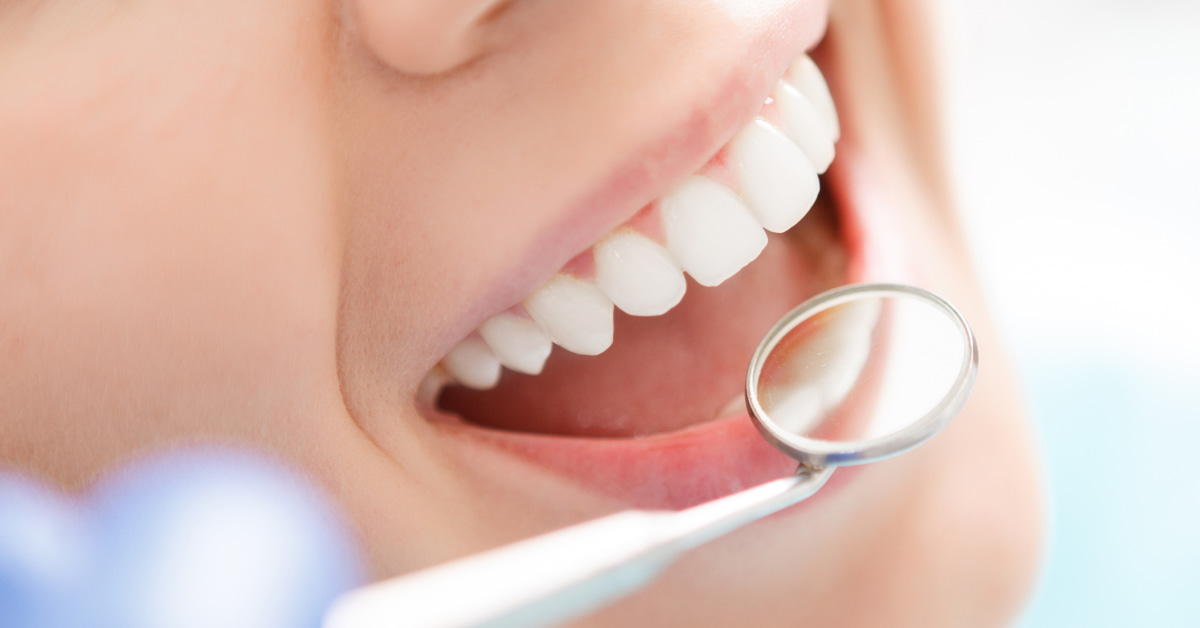 【ホワイトニングをして後悔するのを防ぐ方法】心から満足する施術を受けるためにチェックしておきたいポイントを紹介