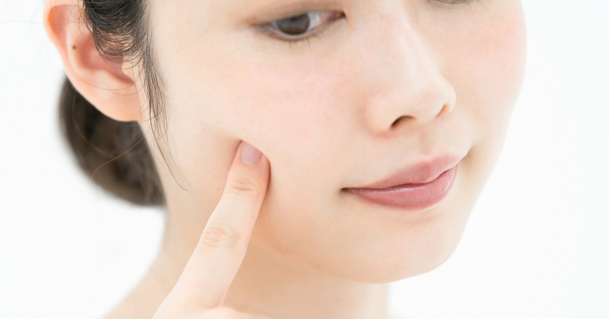 若いのにほうれい線が目立つ原因は骨格が原因って本当?その理由や目立ちやすい顔タイプをくわしく解説