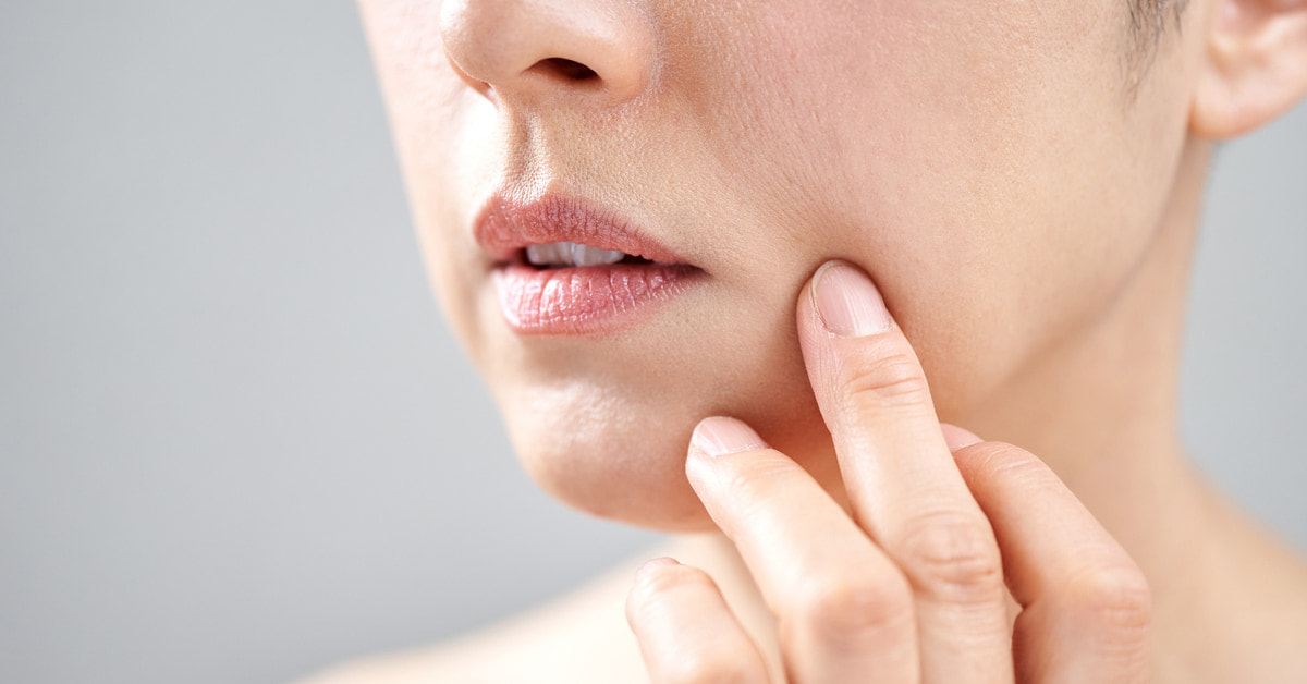 20代のほうれい線ができる8つ理由と対策を伝授◎今のうちに消して笑顔が素敵な大人になろう