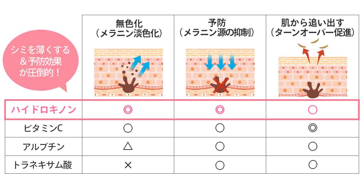 毛穴の種類紹介